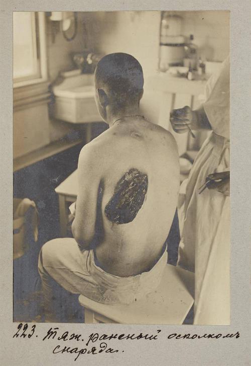 Seriously wounded by shrapnel