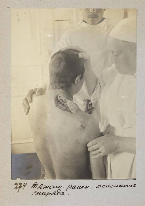 Seriously wounded by shrapnel